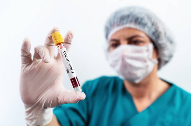 Caruaru registra 78 novos casos de Covid-19 e mais três mortes