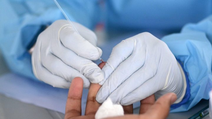 Pernambuco registra 1.455 novos casos de covid-19 e mais 29 óbitos
