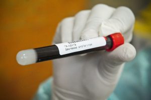 Pernambuco registra 803 novos casos de covid-19; Balanço da vacinação no Estado