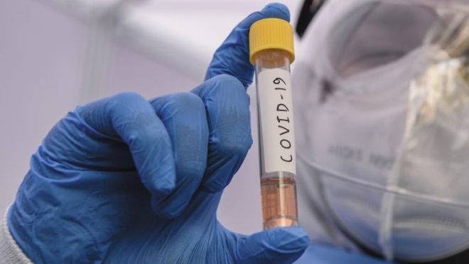 Hospital dos Servidores do Estado inicia imunização com a Covid-19 Pediátrica Hospital dos Servidores do Estado inicia imunização com a Covid-19 Pediátrica