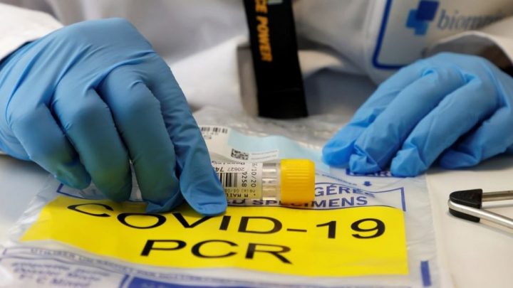 Pernambuco tem 2.031 novos casos e 2.366 recuperados de covid-19