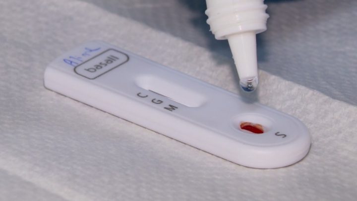 PE tem mais pacientes recuperados do que contaminados de covid-19 nas últimas 24h