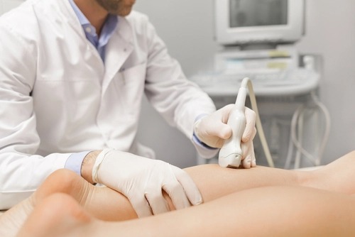 Covid-19 pode deixar sequelas no sistema vascular dos pacientes