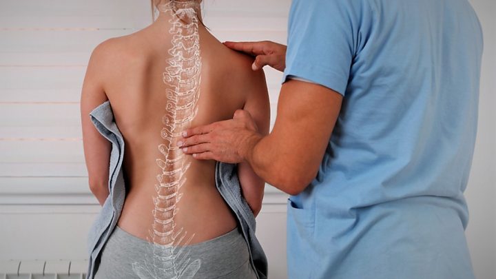 Junho Verde – mês de conscientizar a população sobre a Escoliose: deformidade na coluna vertebral