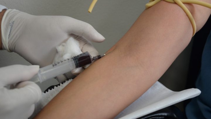 Asces-Unita passa a ofertar exames laboratoriais de alta complexidade