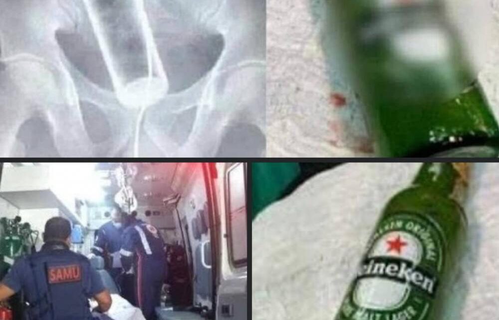 Esposa enfia garrafa no ânus do marido durante relação sexual e ele vai parar no hospital