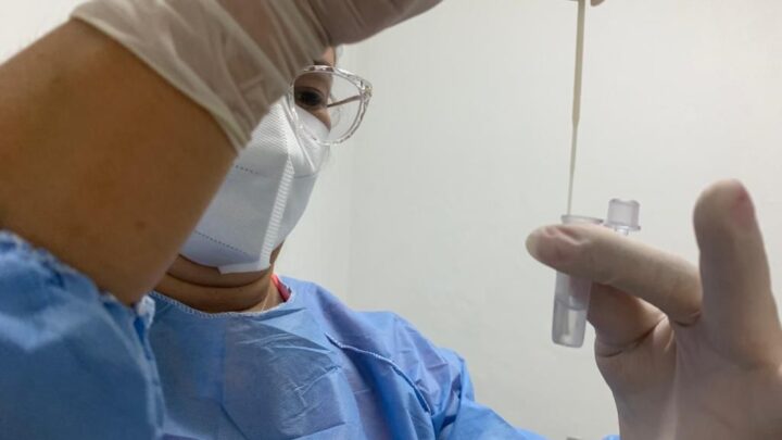 Centro de Testagem Covid-19 volta a funcionar sem necessidade de agendamento