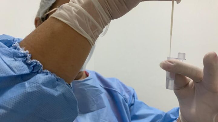 Teste de covid-19 volta a funcionar de segunda a sexta-feira em Caruaru