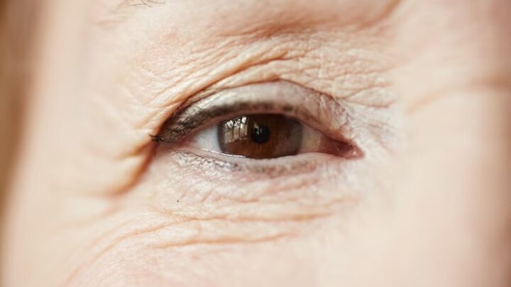 Maio Verde: quase 1,5 milhão de brasileiros não sabem que tem glaucoma