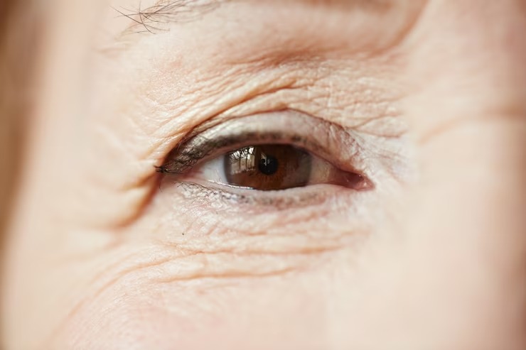 Maio Verde: quase 1,5 milhão de brasileiros não sabem que tem glaucoma