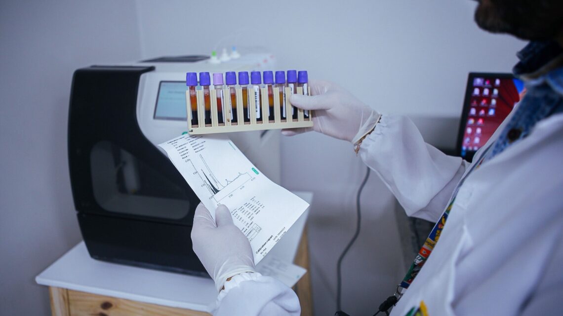 Caruaru conta com exame para diagnóstico de anemia falciforme na rede municipal de saúde Caruaru conta com exame para diagnóstico de anemia falciforme na rede municipal de saúde