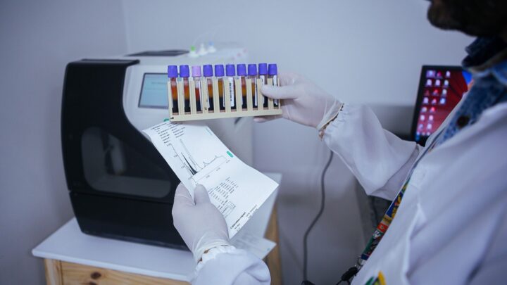 Caruaru conta com exame para diagnóstico de anemia falciforme na rede municipal de saúde