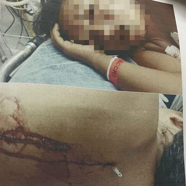Polícia Civil prende homem que tentou matar a própria esposa com facada nas costas Polícia Civil prende homem que tentou matar a própria esposa com facada nas costas
