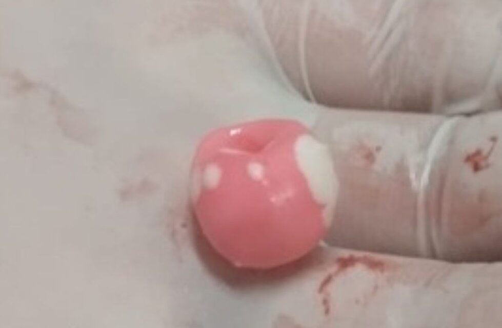 Bebê é salvo após engasgo com pirulito