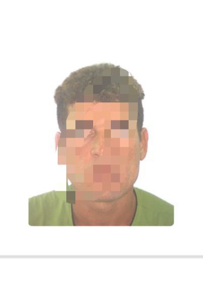 Homicida é preso pela Guarda Municipal de Caruaru