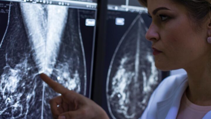 Uma a cada três pernambucanas diagnosticadas com câncer de mama tem menos de 50 anos 