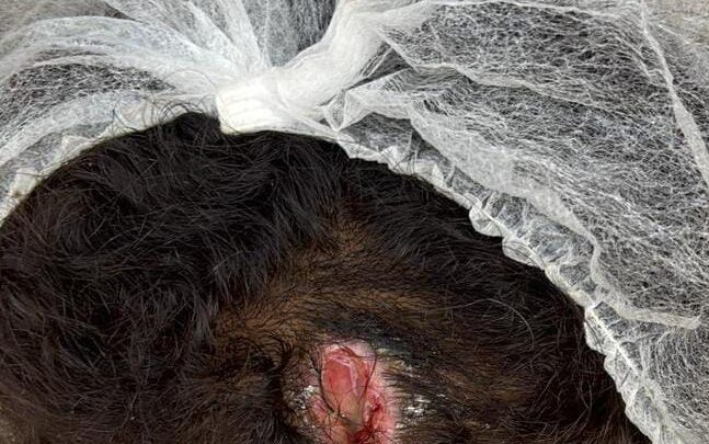 Mulher vítima de violência doméstica é localizada e acolhida, após informações repassadas a Central Disque Denúncia