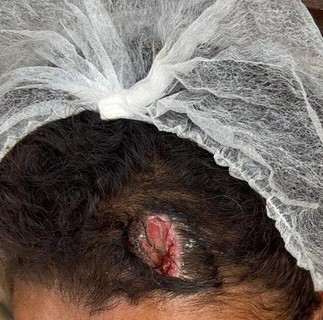 Mulher vítima de violência doméstica é localizada e acolhida, após informações repassadas a Central Disque Denúncia