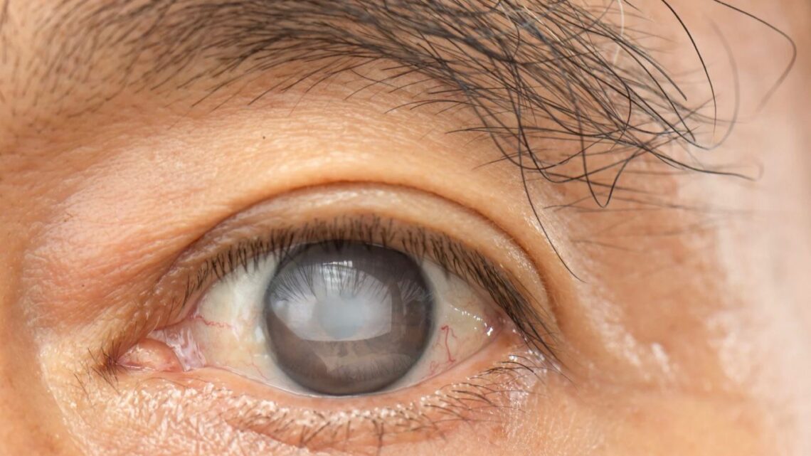 Maio Verde reforça alerta sobre glaucoma, principal causa de cegueira irreversível