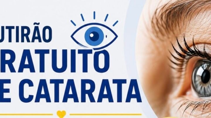 Mutirão gratuito de Catarata será realizado em Caruaru
